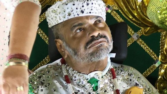 Urgente! Morre Arlindo Cruz, aos 66 anos: sambista lidava com sequelas graves de AVC isquêmico desde 2017