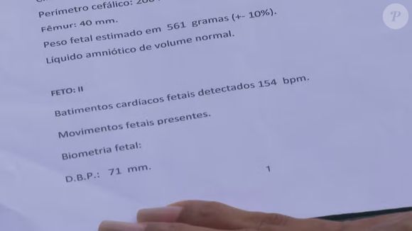 A mãe entregou exames em que mostram que ela fez pré-natal acreditando estar grávida de gêmeas, mas na hora do parto só tinha uma bebê.