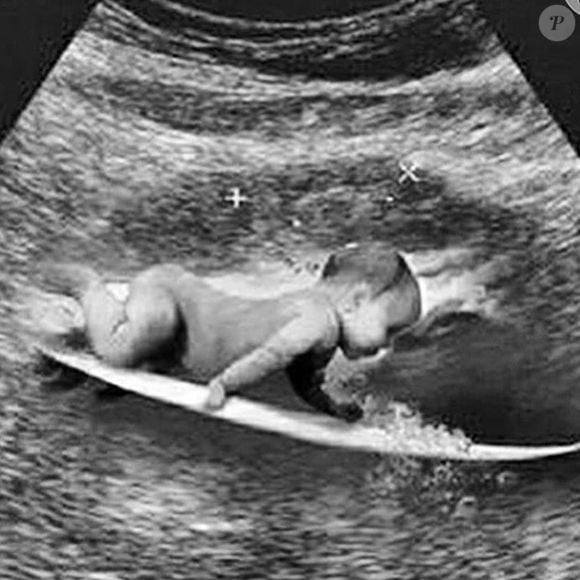Gabriel Medina publicou a foto de uma ultrassonografia diferentona, com um bebê surfista
