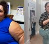 Segundo informações de sites internacionais Bettie Jo Elmore, emagreceu mais de 90 kg - embora tenha perdido ainda mais recentemente