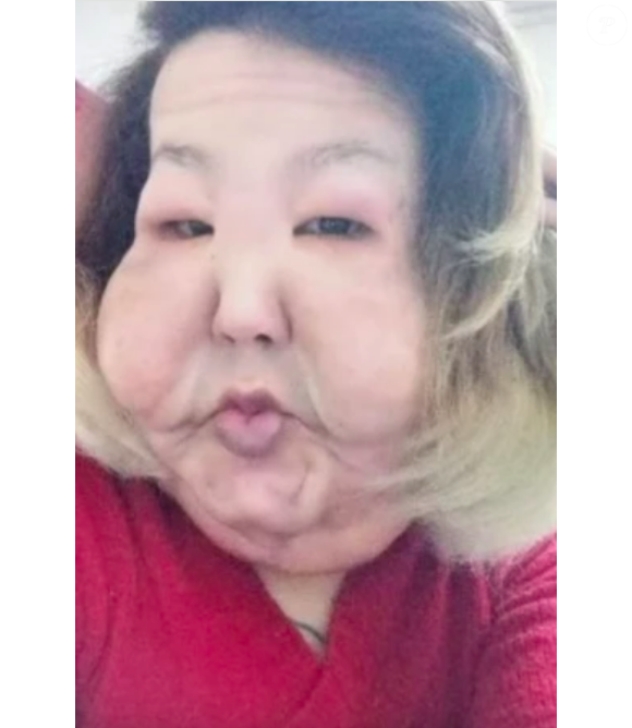 Juju do Pix destinou o dinheiro a outros fins e acabou não realizando o procedimento