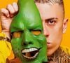 Mc Daniel mostrou sua nova aparência após harmonização facial