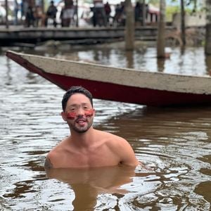 Procedimentos de Rico Melquiades envolveram preenchedores e cuidados com a pele