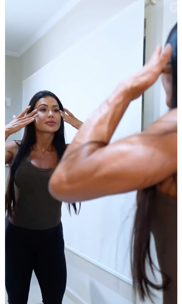 Gracyanne Barbosa revelou ter começado a remover seus preenchimentos no ano passado, e estar em busca de uma beleza mais consciente