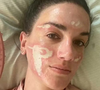 Em um vídeo publicado no Instagram, Victoria Nelson afirmou ter ficado "permanentemente desfigurada" após um tratamento de peeling químico realizado na clínica da esteticista de celebridades Sonya Dakar, em Beverly Hills.