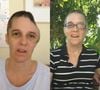 Antes e depois de Renee Murdoch: da internação à quase morte, veja 32 fotos da pastora que inspirou o filme 'Fé Para o Impossível', sucesso na Netflix