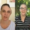 Antes e depois de Renee Murdoch: veja em 32 fotos como está hoje a pastora que ficou entre a vida e a morte após agressão e inspirou o filme 'Fé Para o Impossível'