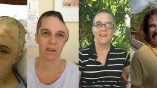 Antes e depois de Renee Murdoch: veja em 32 fotos como está hoje a pastora que ficou entre a vida e a morte após agressão e inspirou o filme 'Fé Para o Impossível'