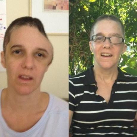 Antes e depois de Renee Murdoch: veja em 32 fotos como está hoje a pastora que ficou entre a vida e a morte após agressão e inspirou o filme 'Fé Para o Impossível'