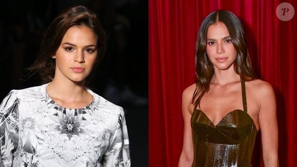 Antes e depois de Bruna Marquezine: atriz tem uma das rinoplastias mais elogiadas do Brasil devido ao seu resultado natural