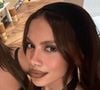 Anitta chocou os fãs, na noite deste sábado (28), ao surgir com um rosto completamente diferente