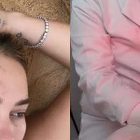 ‘Existe um impacto psicológico significativo': médica especialista faz alerta sobre diagnóstico de Virgínia Fonseca e aponta a importância da avaliação precoce