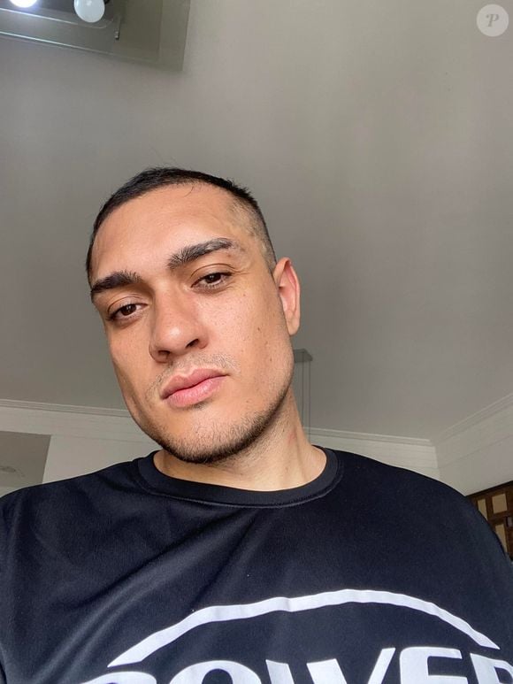 Além da mudança no corpo, MC Binn também fez uma harmonização para contornar seu rosto