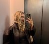Grace Beverley revelou ter sofrido com ganho de peso, inflamações e a sensação de que os hormônios estavam completamente desregulados