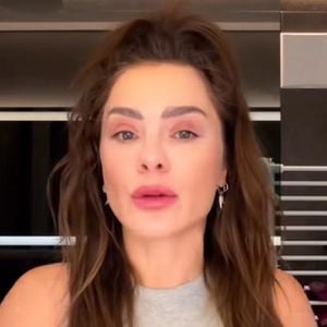 Após levantar suspeitas de preenchimento facial, Dieckmmann reage com franqueza e explica que o inchaço no rosto foi apenas resultado de sono e mudanças de clima