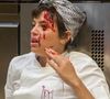 Luma (Agatha Moreira) levou uma frigideira na cabeça de Viola (Gabz) em Mania de Você