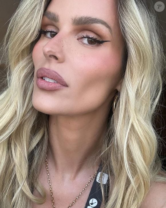 Até o rosto de Yasmin Brunet, que perdeu volume com o emagrecimento, passou a ser alvo de críticas