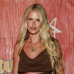 'Fantástico' aborda o Lipedema: em matéria na TV Globo, Yasmin Brunet mostra mostra antes e depois e faz revelação: 'Já estava ali...'