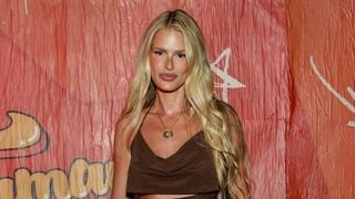 Lipedema no 'Fantástico': em matéria na TV Globo, Yasmin Brunet mostra mostra antes e depois e faz revelação: 'Já estava ali...'