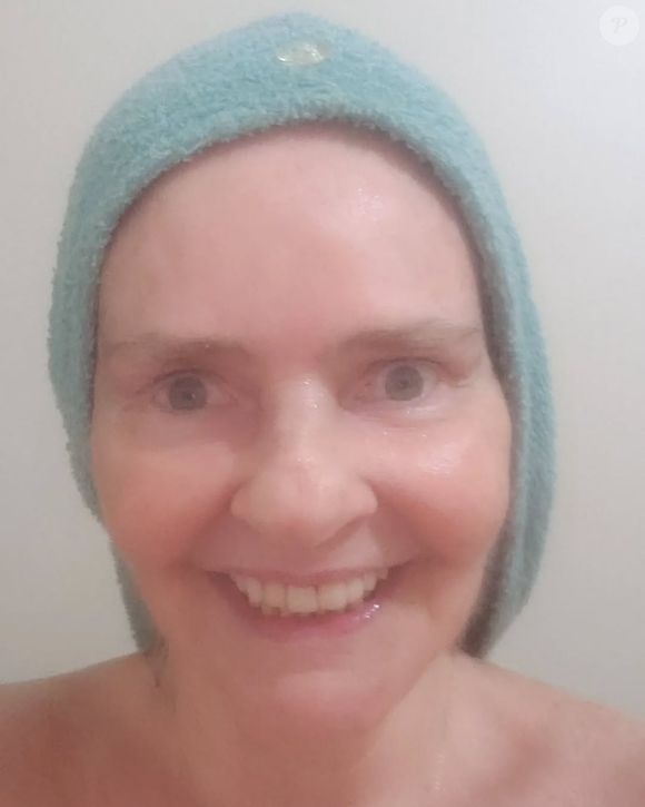 Angela Ro Ro: ‘No ano passado, por causa de um choque anafilático, quase morri. Tomei complexo vitamínico na veia’