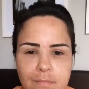 Internautas se assustaram com a aparência de Ana Paula Renault e alguns chegaram a dizer que não se tratava da sister