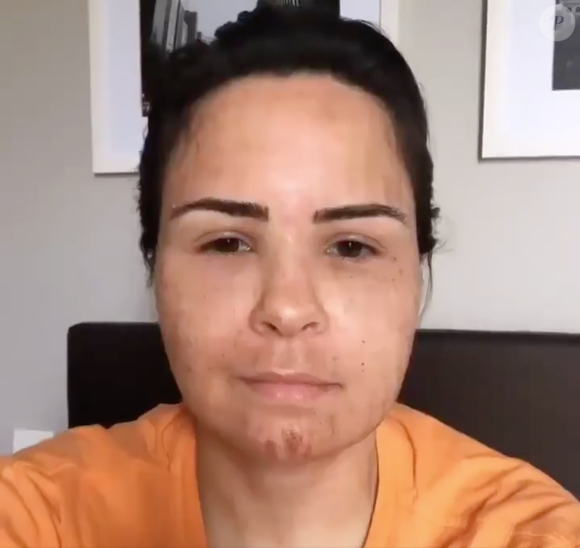 Internautas se assustaram com a aparência de Ana Paula Renault e alguns chegaram a dizer que não se tratava da sister