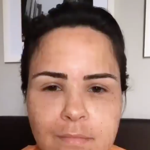 Internautas se assustaram com a aparência de Ana Paula Renault e alguns chegaram a dizer que não se tratava da sister