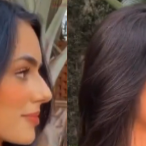 Rinoplastia: antes e depois de Bruna Biancardi