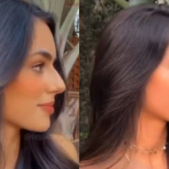 Rinoplastia: antes e depois de Bruna Biancardi