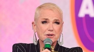 Alopécia androgenética feminina tem cura? 4 tratamentos inovadores que ajudam na queda de cabelo que afeta Xuxa e outras famosas