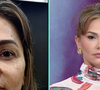 Antes e depois de Suzana Alves: resultado da harmonização facial foi mostrado no 'Fofocalizando'