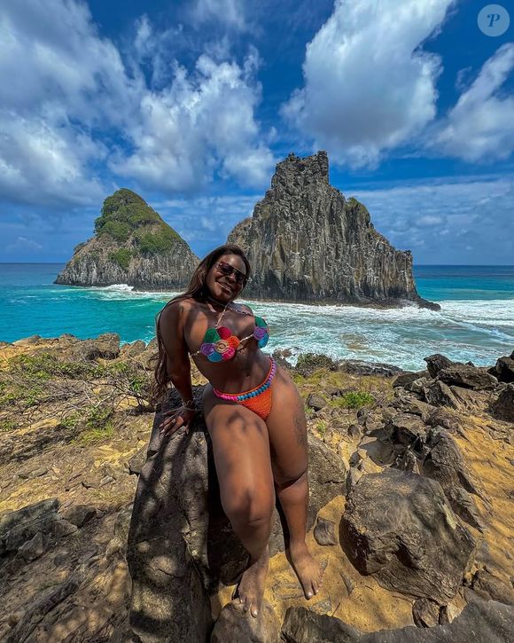 Corpo real das famosas: Jojo Toddynho também já fez uma cirurgia bariátrica.