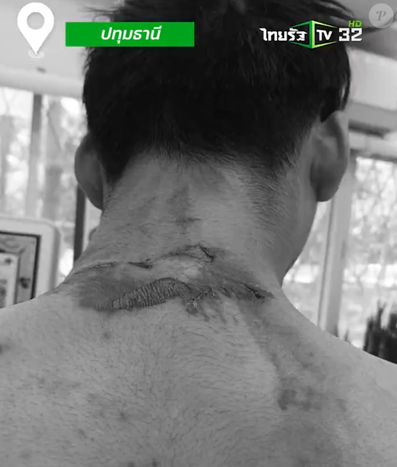 Vingança, sopa fervente e cabelo cortado: Mister Teen Global é vítima de violência brutal na Tailândia e situação vira caso de polícia