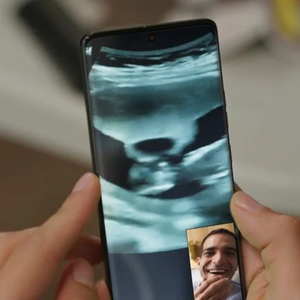 Erro da Globo: Afonso parece mutante com três mãos ao segurar celular
