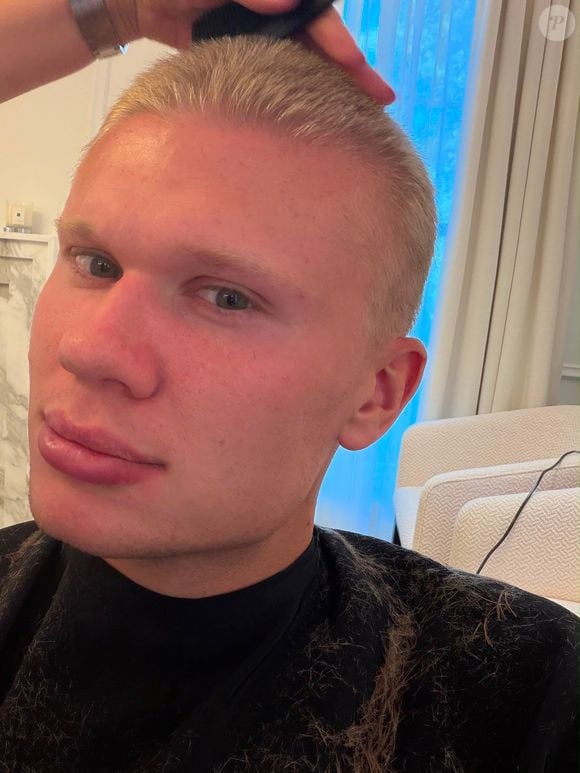 Haaland corta o cabelo: o astro do Manchester City decidiu deixar para trás os longos cabelos que se tornaram uma de suas principais marcas visuais