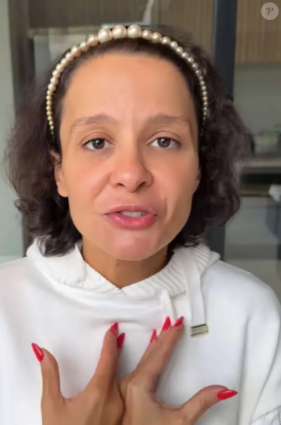 Maiara é outra famosa que abriu publicamente o diagnóstico de alopecia