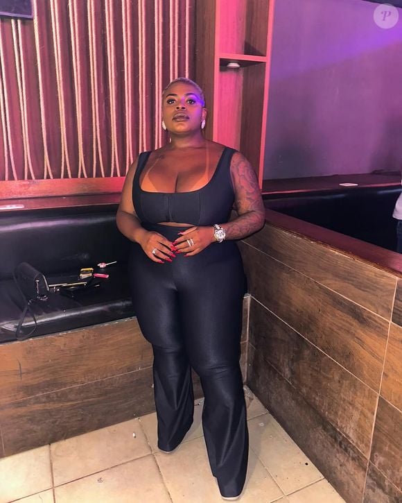 Jojo Todynho também realizou uma abdominoplastia na barriga, para se livrar da flacidez na pele
