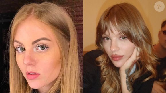 Quem conheceu Luísa Sonza antes dos procedimentos estéticos se impressiona com a transformação da cantora após o preenchimento labial