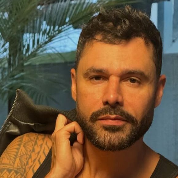 Rodrigo Sant'Anna também fez uma rinoplastia para mudar o formato do nariz