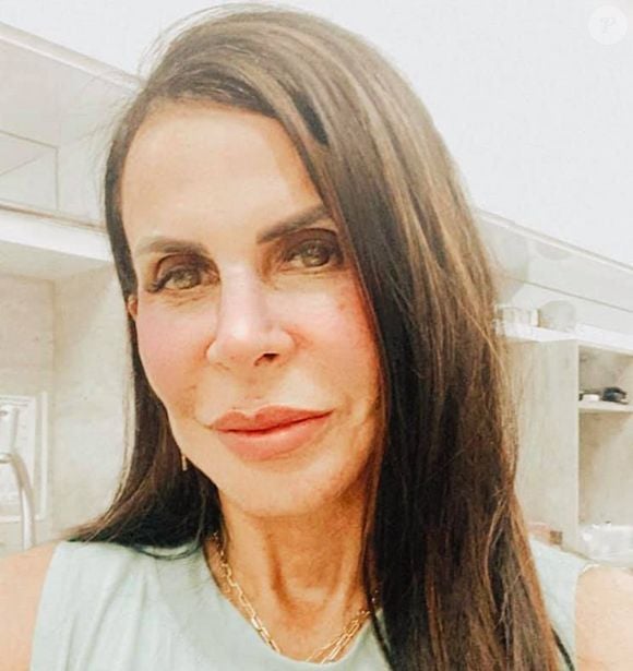 Gretchen também realizou um procedimento para acabar com as olheiras