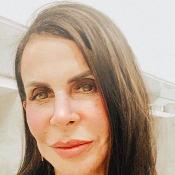 Gretchen também realizou um procedimento para acabar com as olheiras