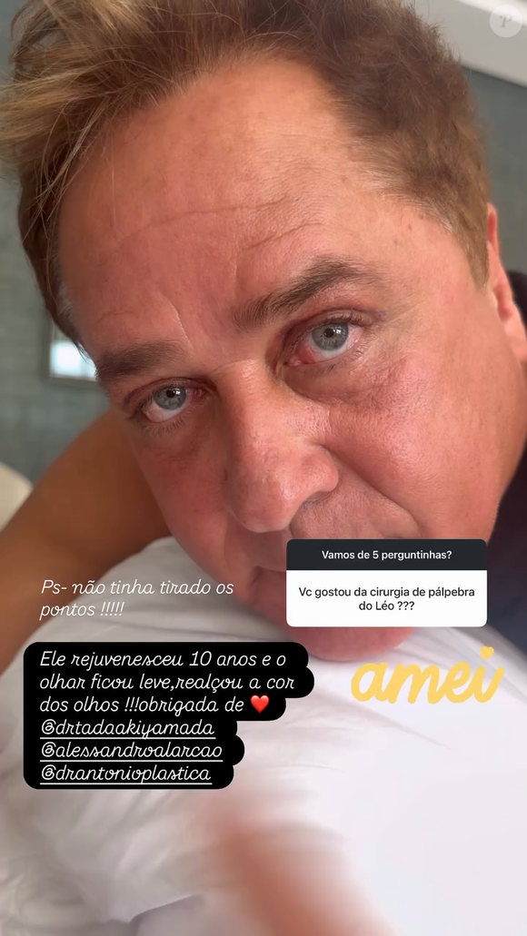 Leonardo passou por uma blefaroplastia no início deste ano