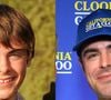 Antes e depois de Zac Efron: ator de 'High School Musical' ficou irreconhecível após um acidente doméstico