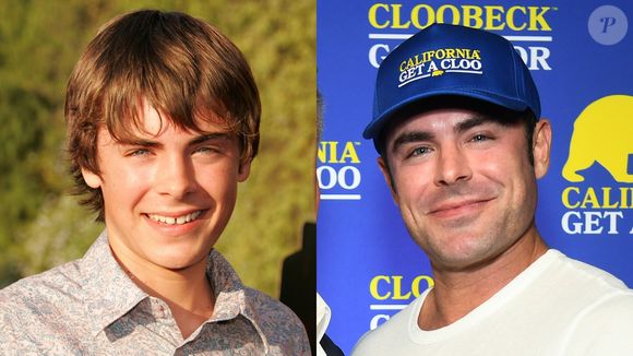 Antes e depois de Zac Efron: ator de 'High School Musical' ficou irreconhecível após um acidente doméstico