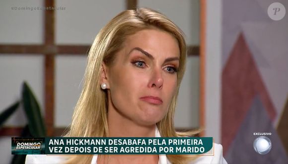 Ana Hickmann se separou de Alexandre Correa após acusá-lo de agressão