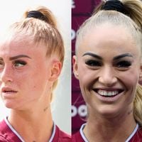 Antes e depois de Alisha Lehmann: jogadora de futebol mais seguida do mundo passou por transformação polêmica no rosto e 30 fotos vão te chocar