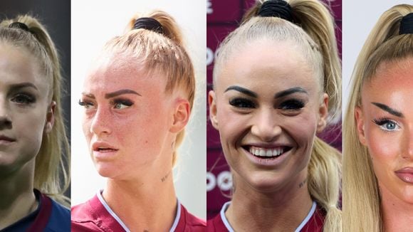 Antes e depois de Alisha Lehmann: jogadora de futebol mais seguida do mundo passou por transformação polêmica no rosto e 30 fotos vão te chocar