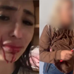 Imagens fortes! Ex-bailarina do Faustão é esfaqueada pela mãe usuária de crack: ‘Tô cuspindo sangue’