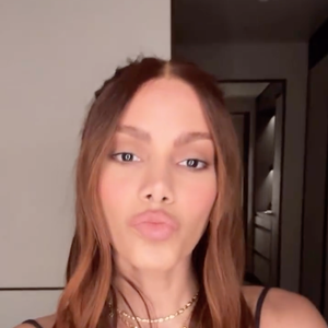 De acordo com a Dra. Fernanda Nichelle, Anitta também pode ter feito procedimentos menos invasivos, como a aplicação de ácido hialurônico em pontos estratégicos ou o uso de tecnologias modernas