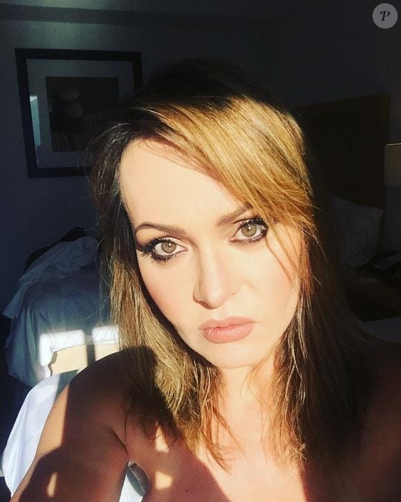 Gaby Spanic passou a apostar em procedimentos estéticos para garantir o rejuvenescimento